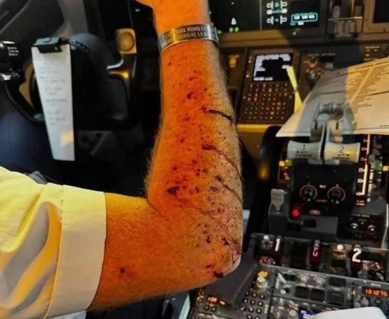 A United Airlines Boeing 737 MAX 8 flight, which was travelling from Denver to Los Angeles, experienced a horrifying incident after it was forced to make an emergency landing after its cockpit windshield was hit by an unidentified object last week